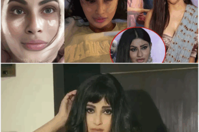 Mouni Roy Looks Unrecognizable after her shocking Plastic surgery gone Wrong with Lip Fillers &Botox
