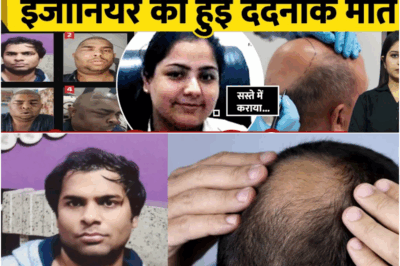 Engineer Dies After Hair Transplant in Kanpur: Swollen Face and Agonizing Pain All Night