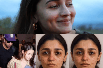Alia Bhatt Stuns in Her No-Makeup Look, Flaunts Imperfections with Pride Alongside Ranbir Kapoor