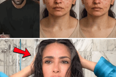 Alia bhatt Looks Stunning in her No Makeup Look flaunt her Imperfaction with Pride with Ranbir!