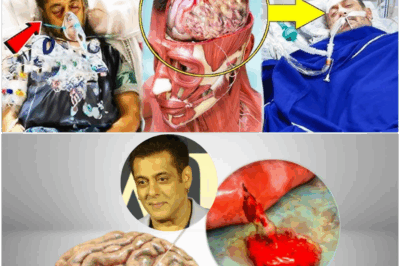 How dangerous is this disease of Salman Khan, will Salman be able to survive or not! Salman Khan brain disease