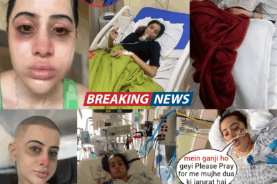 Urfi Javed: The Bold Decision to Dissolve Lip Fillers After 9 Years—A Lesson in Self-Acceptance and Social Media Transparency