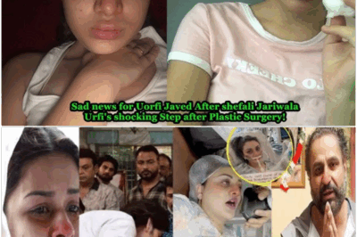 Uorfi Javed’s Shocking Big Step😭after shefali Jariwala over Plastic Surgery Gone Wrong with Her!