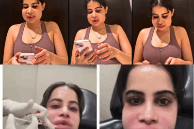 You Won’t Believe What Happened to Urfi Javed After Her Lip Procedure—Her Swollen Face Sparks Shocking Side Effects and Backlash!