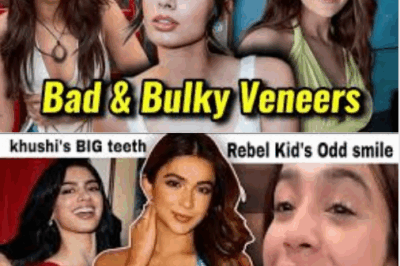 KHUSHI KAPOOR & REBEL KIDS BULKY VENEERS: KUSHA KAPILA’S SMILE TRANSFORMATION