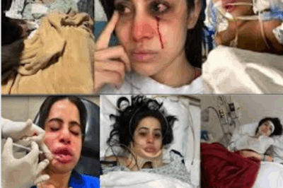 Sad news for Urfi Javed as Urfi Javed admit to Hospital after Attacked and in Critical Condition!