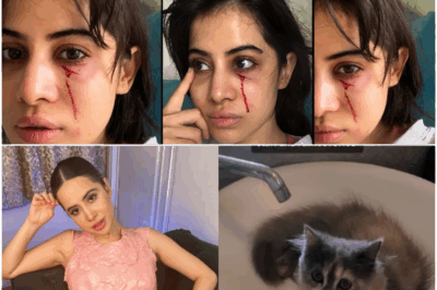 Urfi Javed Attacked Inside Her Own House By Her Pet Cat