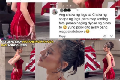 NAG-ALALA para kay Anne Curtis ang FANS matapos MAY MAPANSIN na KAKAIBA sa KANYANG KATAWAN!!